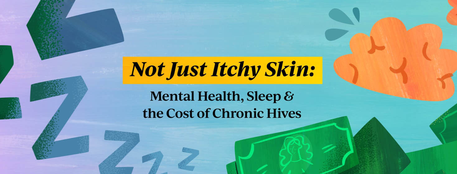 Not just itchy skin: mental health, sleep, and the cost of chronic hives