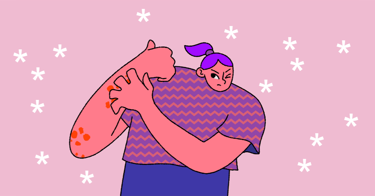 How Corticosteroids Are Used to Treat Chronic Hives